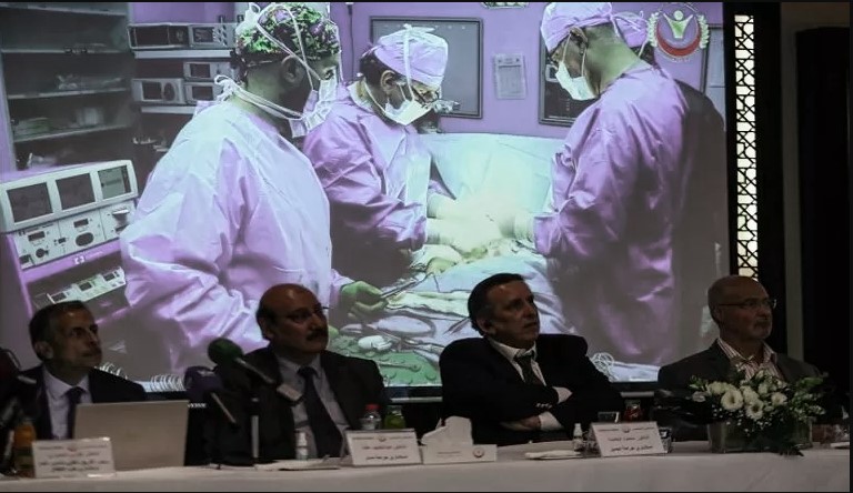 فريق طبي أردني ينجح في فصل توأم سيامي يمني بعملية نادرة