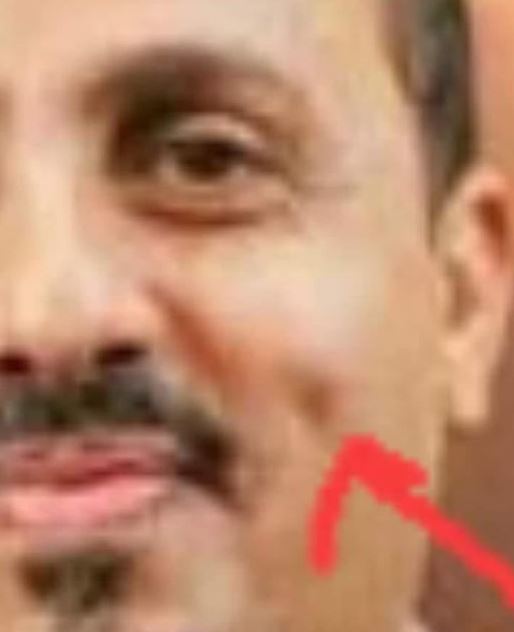غمازات خدود عملية باهظة جدا لوزير في حكومة معين عبدالملك الاسم صورة