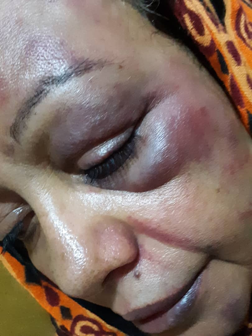 شاهد إصابة قاضية وسط العاصمة عقب اعتداء وحشي من زوج ابنتها
