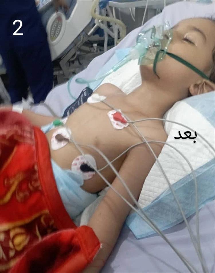 منذ 9 أشهر.. الطفل تيم محمود في غيبوبة والسبب..!!