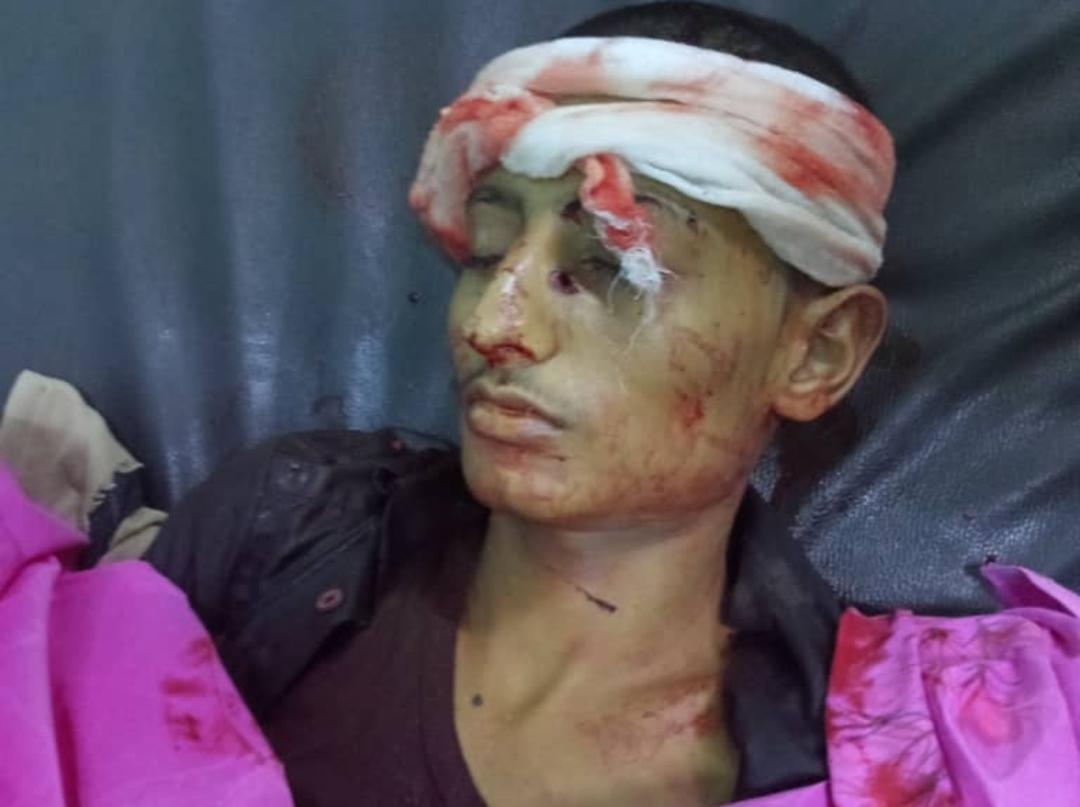 ورد الآن.. شقيق قائد المليشيا يقتل مرافقه الشخصي (الأسم + صورة)
